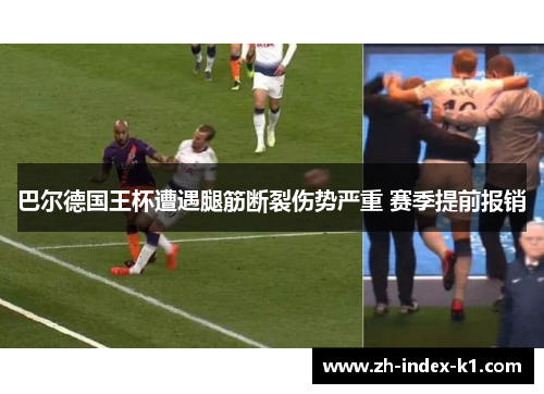 巴尔德国王杯遭遇腿筋断裂伤势严重 赛季提前报销 巴尔德国王杯遭遇腿筋断裂伤势严重 赛季提前报销